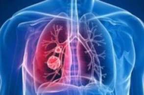 HXQC Re-Announcement of the Global cause of COVID-19